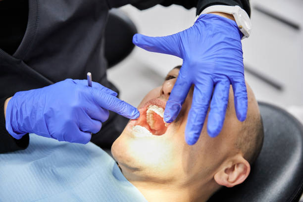 Best Emergency Tooth Extraction in Minden, NV