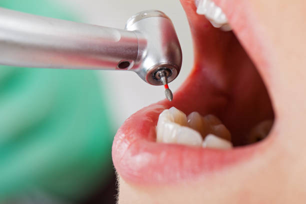 Best Emergency Treatment for Dental Infections or Abscesses in Minden, NV